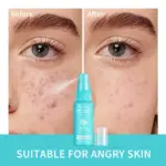 Reduce Redness Toner - Image 3