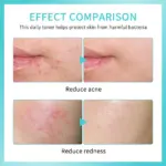 Reduce Redness Toner - Image 4