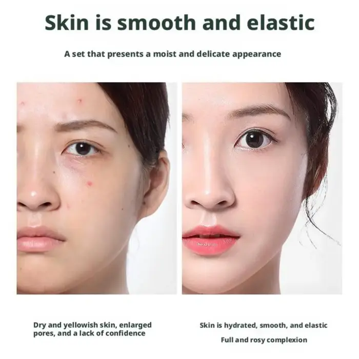 100ML Moisturize Toner - Image 5