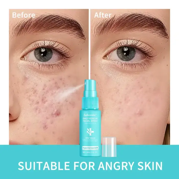 Reduce Redness Toner - Image 1